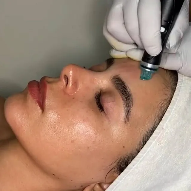 Centro Estético Amorami tratamiendo facial